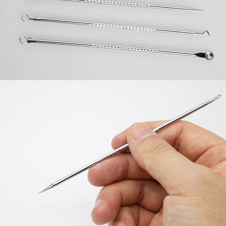 4-Piece Stainless Steel Acne & Blackhead Extractor Set – Pore Cleanser Kit