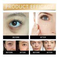 Eelhoe Concealer & Hydrating Liquid Foundation – Dark Circles, Freckles & Blemishes | Buyer's Choice