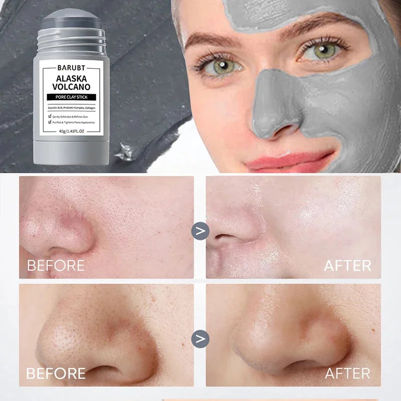 Jaysuing Cleansing Mask Stick – Mugwort, Alaska Volcano & More | Pore Minimizer & Acne Treatment 40g