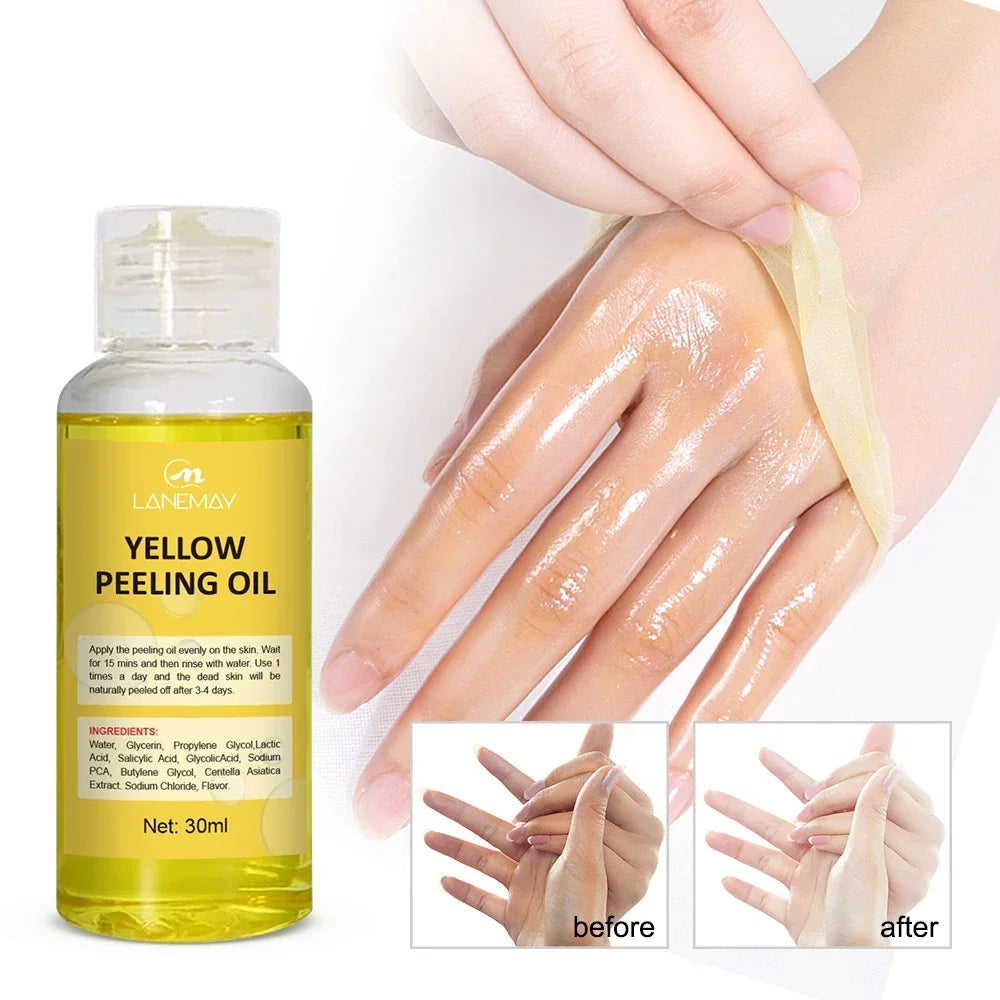 EELHOE Yellow Peeling Oil – Exfoliating Body Serum for Dark Spots, Knees, Elbows & Uneven Skin Tone (30ml / 50ml / 100ml)