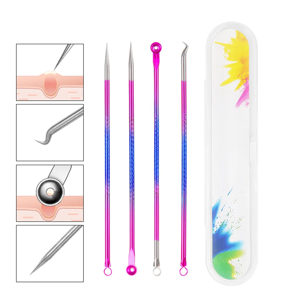4-Piece Acne & Blackhead Remover Needle Set – Metal Pore Cleaning Tool Kit