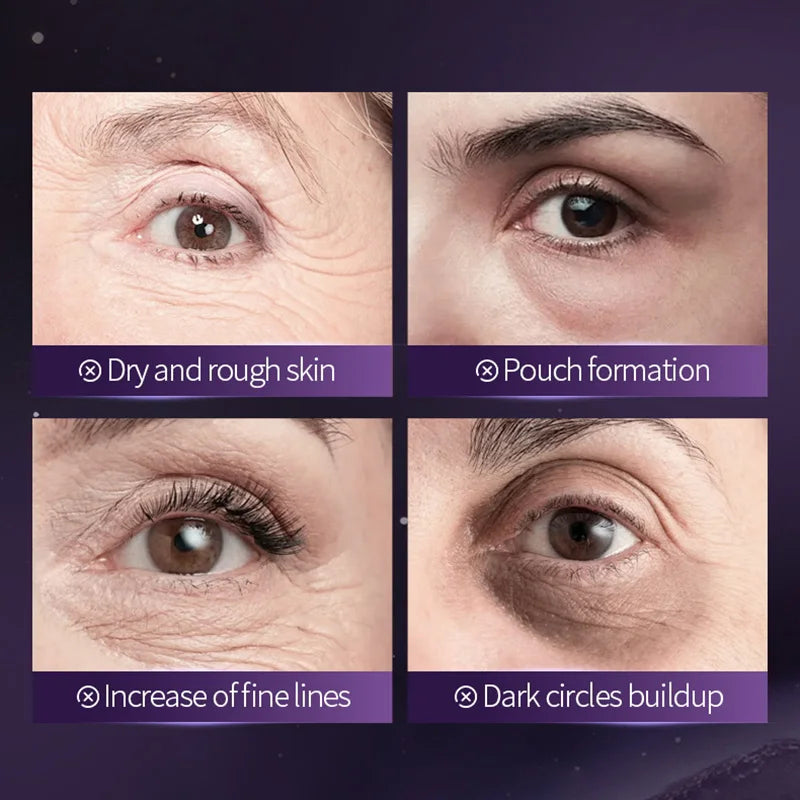 SADOER Grape Crystal Collagen Eye Masks — 60 Pcs Anti Dark Circles, Anti-Aging & Moisturizing Eye Patches