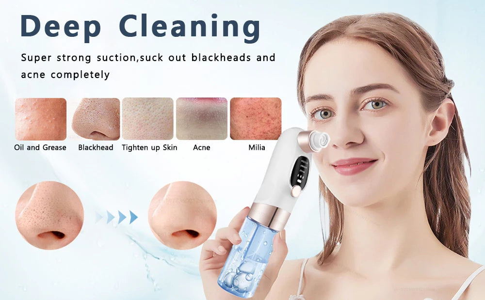 BXA Electric Blackhead Remover Pore Vacuum – Water Cycle Deep Cleansing | USB Rechargeable