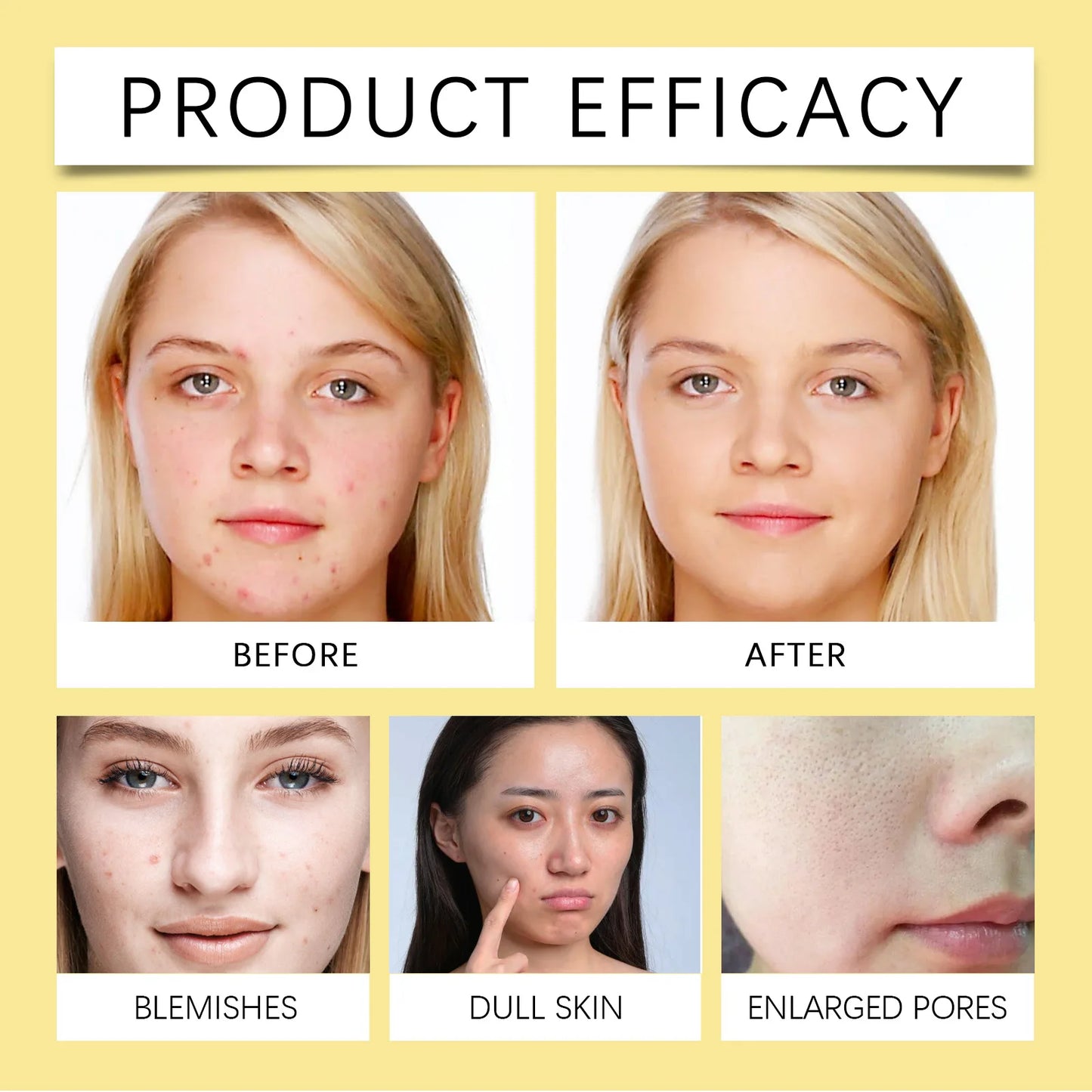 EELHOE Niacinamide Whitening Facial Cleanser – Deep Cleansing & Brightening Face Wash (100g)