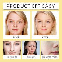 EELHOE Niacinamide Whitening Facial Cleanser – Deep Cleansing & Brightening Face Wash (100g)