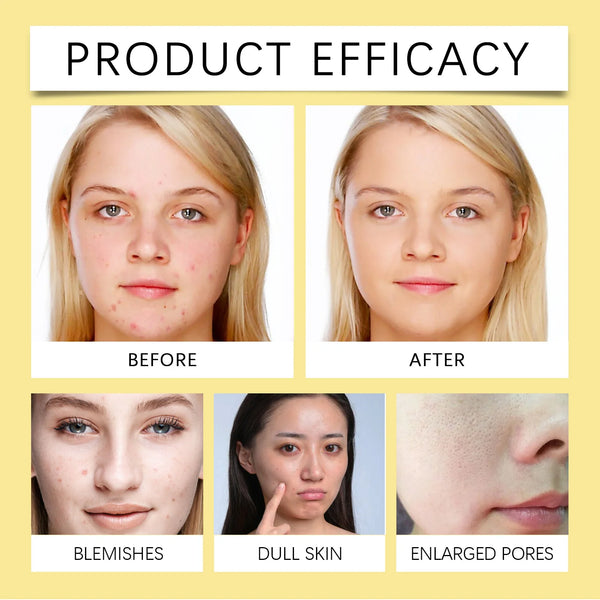 EELHOE Niacinamide Whitening Facial Cleanser – Deep Cleansing & Brightening Face Wash (100g)