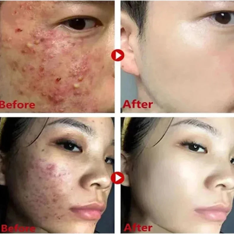 Jaysuing Cleansing Mask Stick – Mugwort, Alaska Volcano & More | Pore Minimizer & Acne Treatment 40g