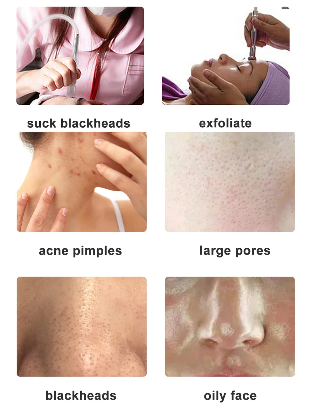Diamond Tip Microdermabrasion Machine – 9-Head Vacuum Exfoliation & Spray Device