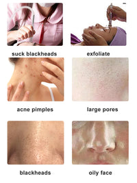 Diamond Tip Microdermabrasion Machine – 9-Head Vacuum Exfoliation & Spray Device