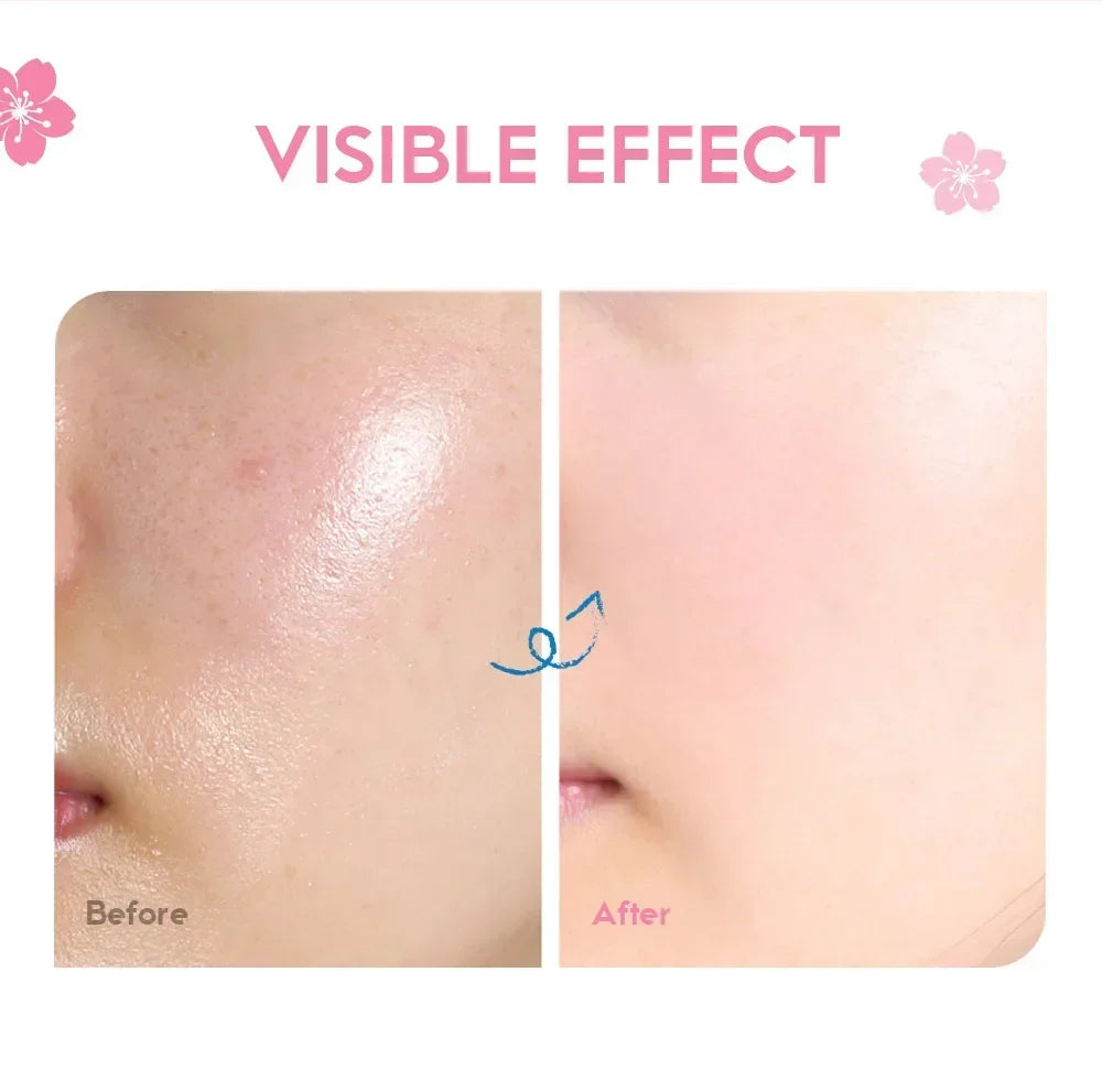 LAIKOU Sakura Hydrating cream  Moisturizer Whitening Nourishing Oil Control  Moisturizing & Repairing Deep Hydration Lock Gentle