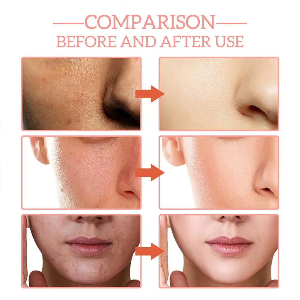 5-in-1 Vitamin C & Hyaluronic Acid Face Serum