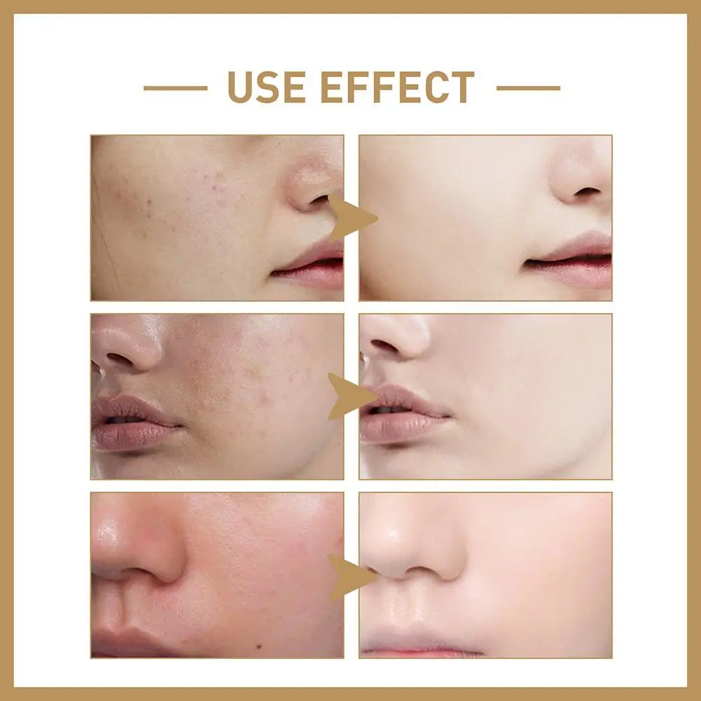 EELHOE Rice Face Toner – Hydrating & Barrier-Repair Skin Lotion for Softening, Firming & Moisturizing (150ml)