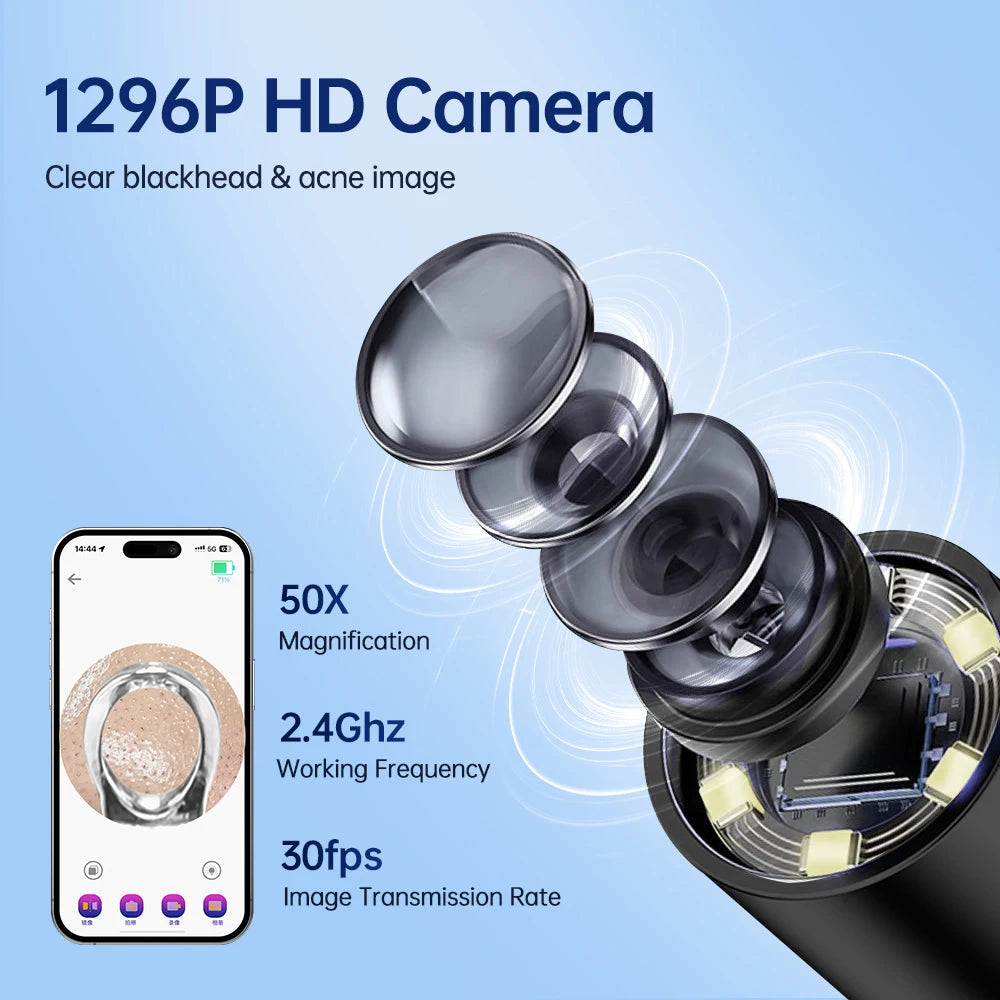 Hailicare Visual Blackhead Remover – 50x HD Camera, Wi-Fi App & LED Light | Acne Pore Cleaner Kit