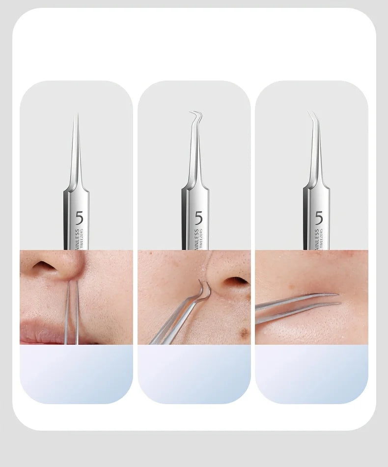 YJYIBEI Stainless Steel Acne Removal Tool Set – Blackhead & Pimple Popper Kit | 4, 7 or 8pcs