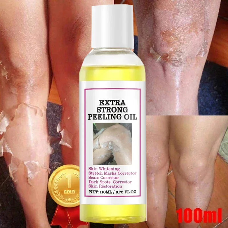 EELHOE Vitamin C & Hyaluronic Acid Body Peeling Lotion – Exfoliating & Brightening Skin Renewal Treatment (100ml)