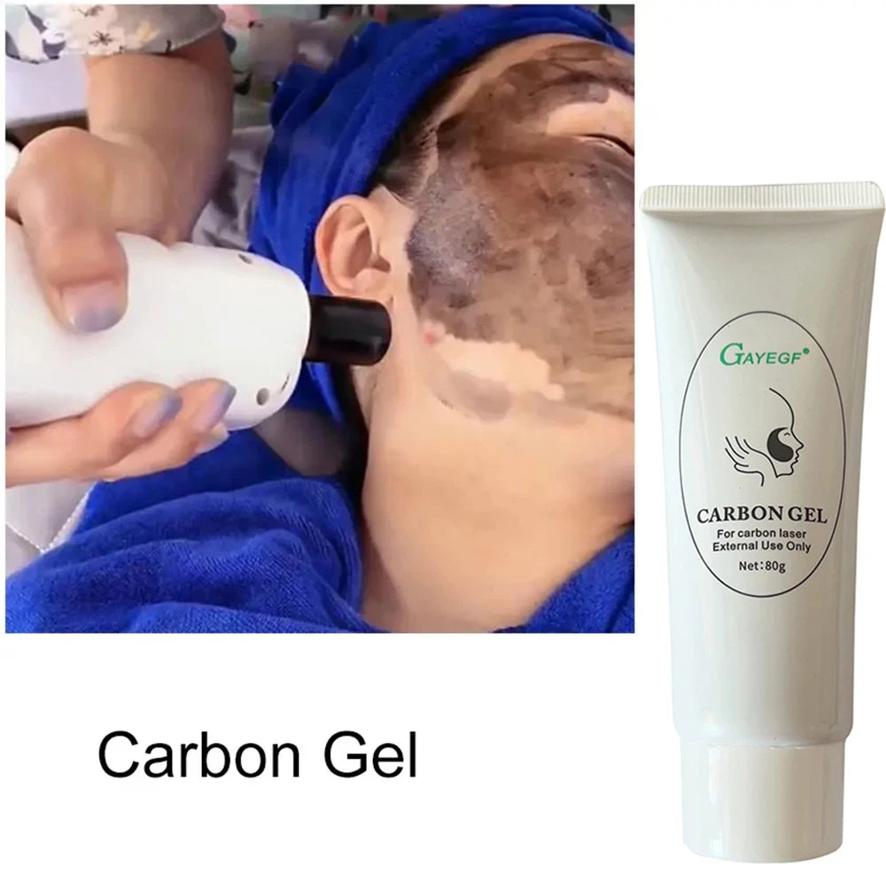 Carbon Black Gel Mask for ND:YAG Laser – Skin Peeling, Pore Minimizing & Whitening Carbon Cream (80ml)