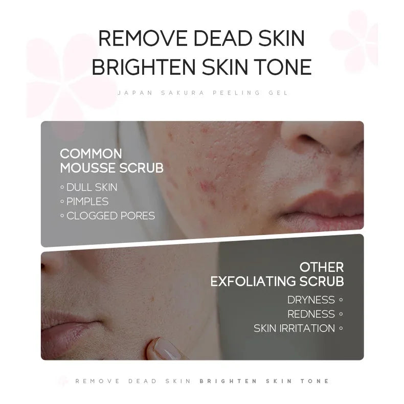LAIKOU Sakura Peeling Gel – Pore-Cleansing Facial Exfoliator with Green Tea Extract & Oil Control (60g)
