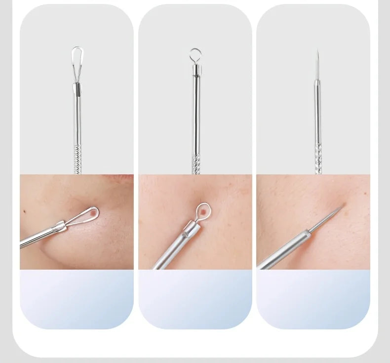 YJYIBEI Stainless Steel Acne Removal Tool Set – Blackhead & Pimple Popper Kit | 4, 7 or 8pcs