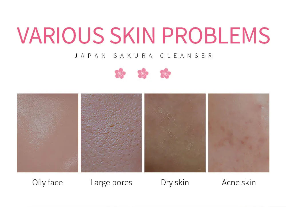 LAIKOU Sakura Facial Cleanser – Deep Cleansing, Oil Control & Brightening Face Wash (50g)