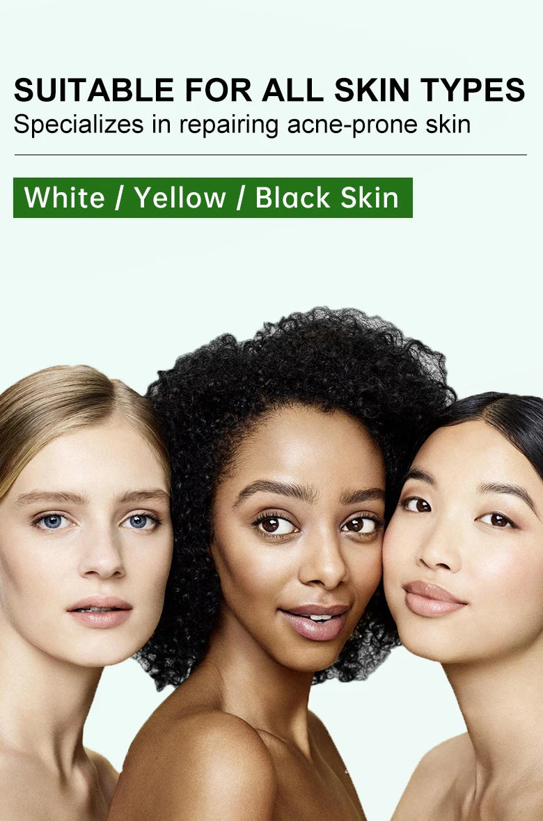 Blackhead Remover Face Cream Enlarged Pores Removal Oil Control Pore Shrinkage Facial Cream Skin Care Set Beauty Health