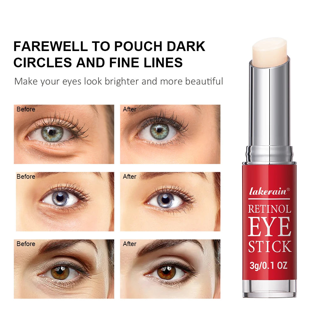 Retinol Eye Cream Stick – Anti-Aging Dark Circle & Firming Eye Balm for Puffiness, Fine Lines & Brightening (3g)