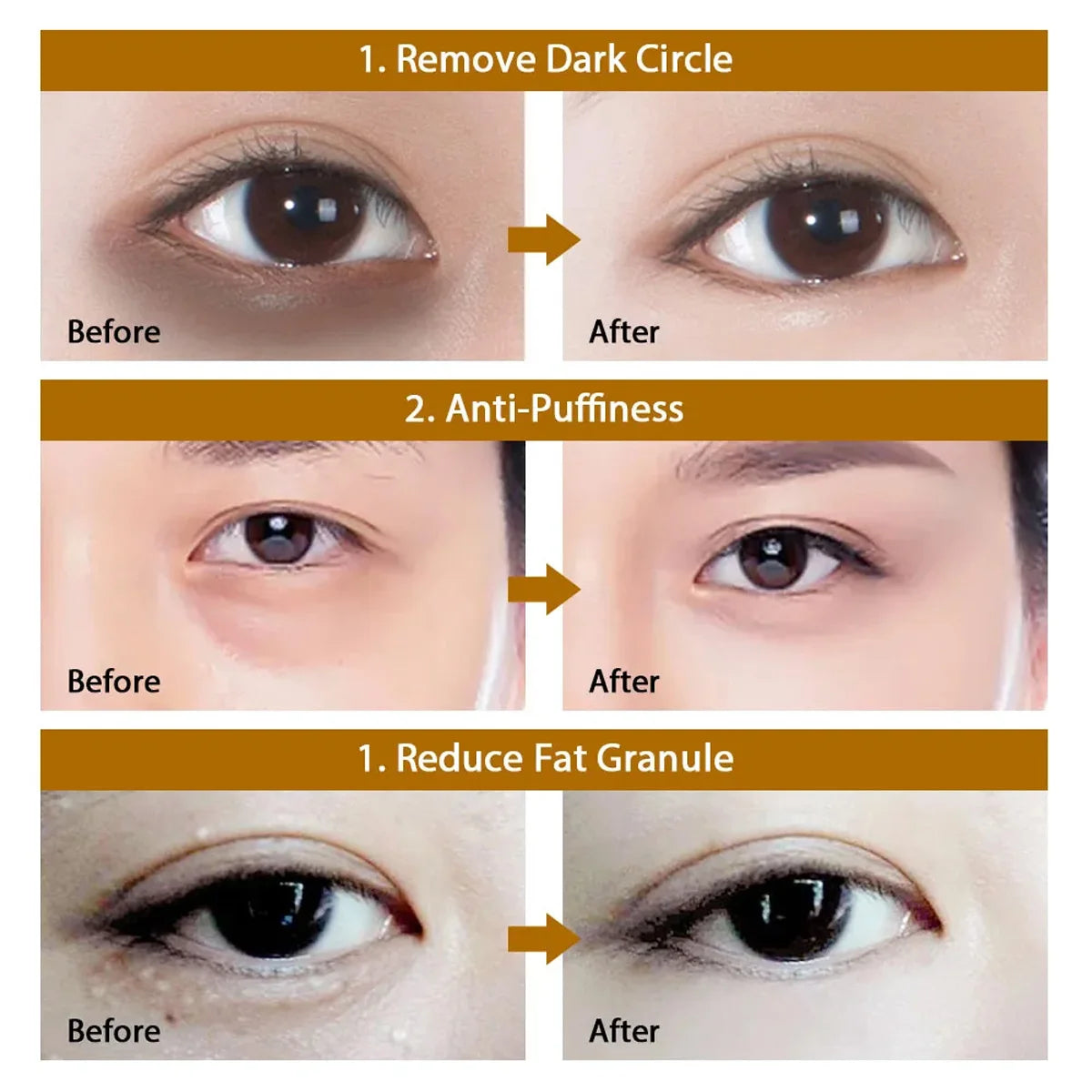 Gold Hyaluronic Acid Eye Mask Patches – 60 Pieces, Firming & Dark Circle Repair