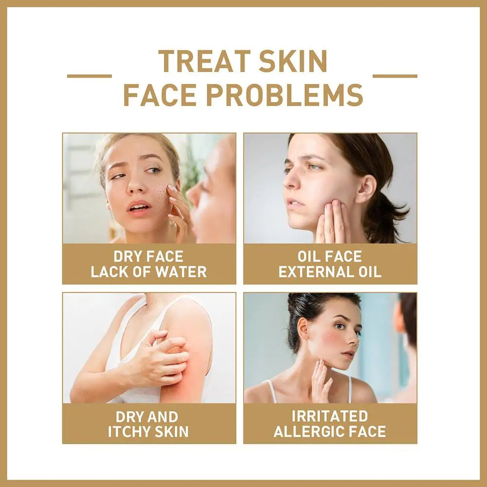 EELHOE Rice Face Toner – Hydrating & Barrier-Repair Skin Lotion for Softening, Firming & Moisturizing (150ml)