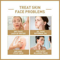 EELHOE Rice Face Toner – Hydrating & Barrier-Repair Skin Lotion for Softening, Firming & Moisturizing (150ml)
