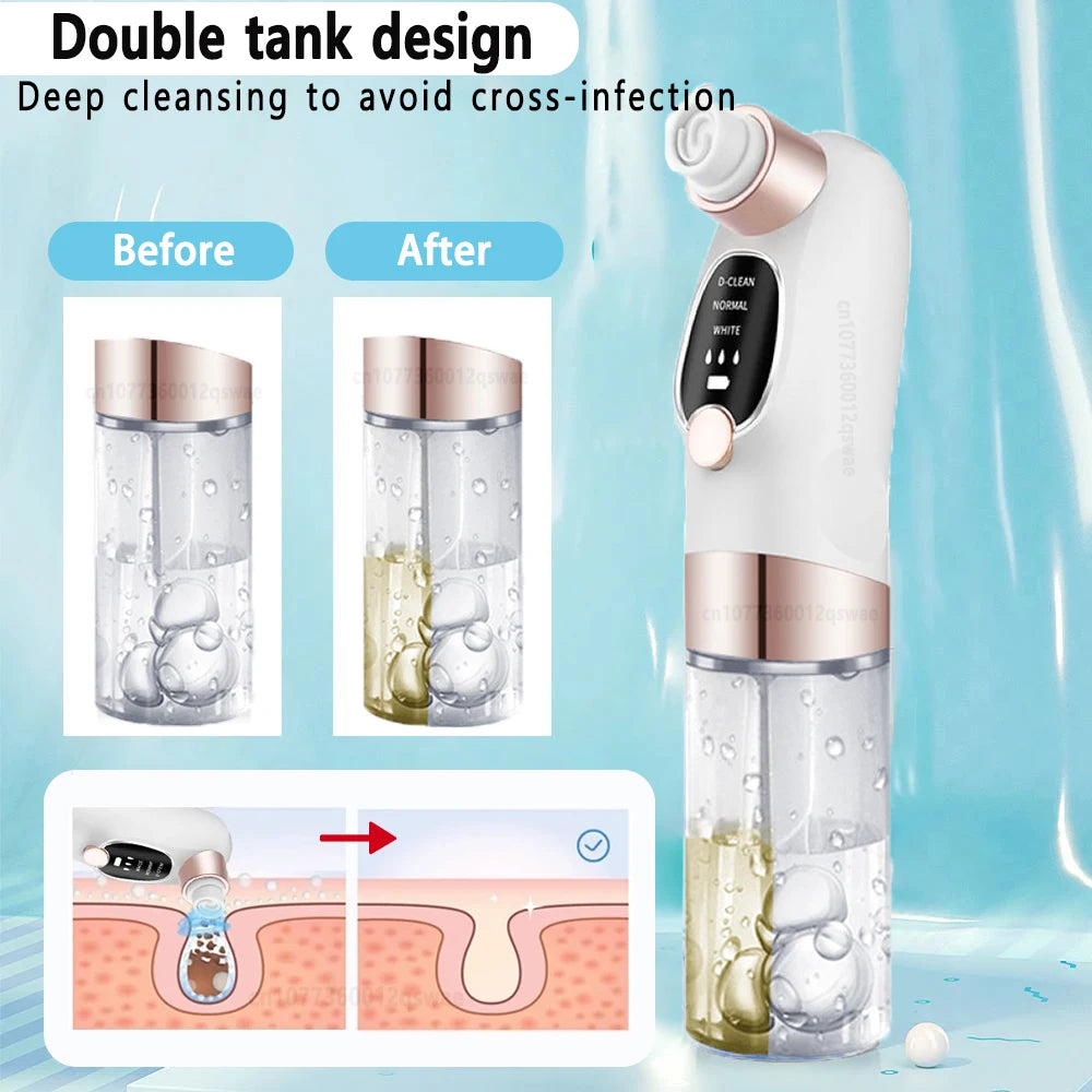 BXA Electric Blackhead Remover Pore Vacuum – Water Cycle Deep Cleansing | USB Rechargeable