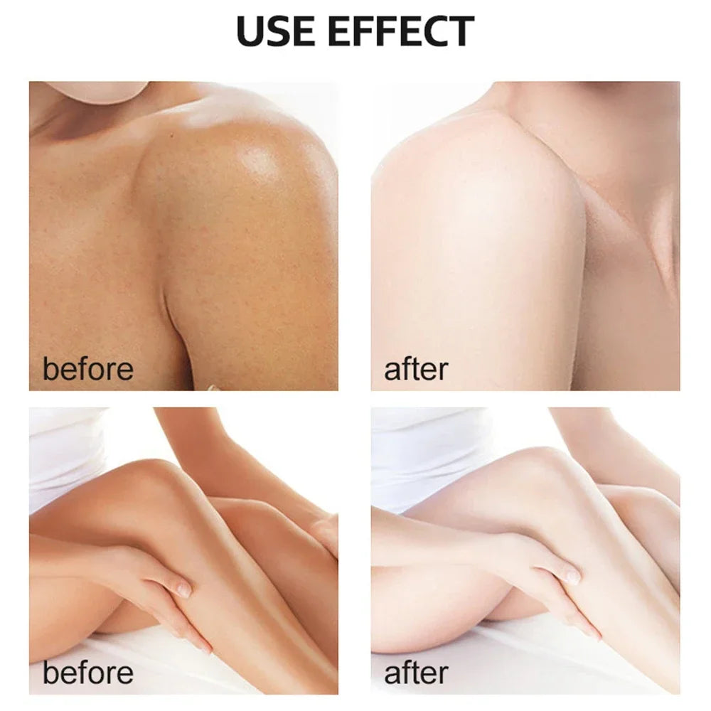 EELHOE Yellow Peeling Oil – Exfoliating Body Serum for Dark Spots, Knees, Elbows & Uneven Skin Tone (30ml / 50ml / 100ml)