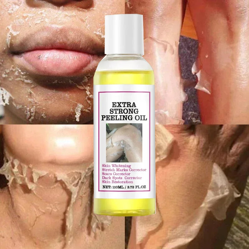 EELHOE Vitamin C & Hyaluronic Acid Body Peeling Lotion – Exfoliating & Brightening Skin Renewal Treatment (100ml)