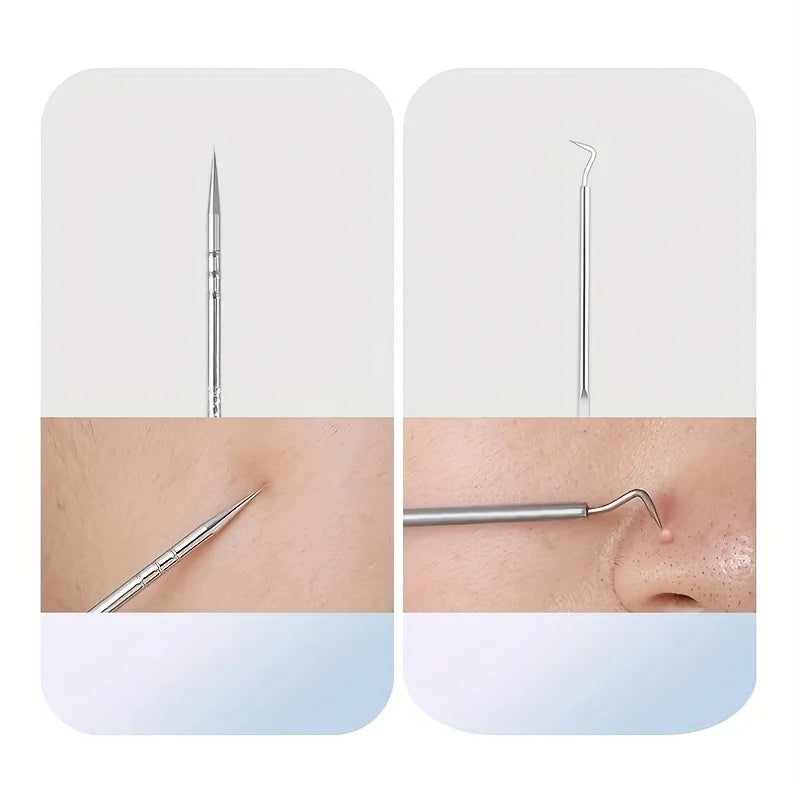 YJYIBEI Stainless Steel Acne Removal Tool Set – Blackhead & Pimple Popper Kit | 4, 7 or 8pcs