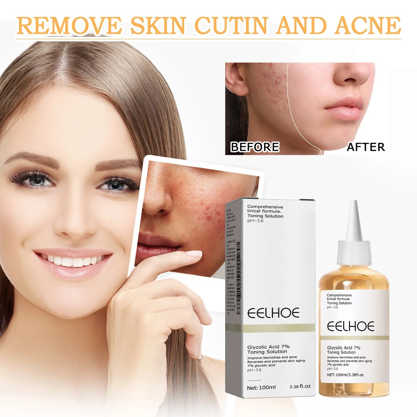EELHOE Glycolic Acid 7% Toner – Exfoliating & Pore-Minimizing Face Toner for Clear, Glowing Skin (100ml)