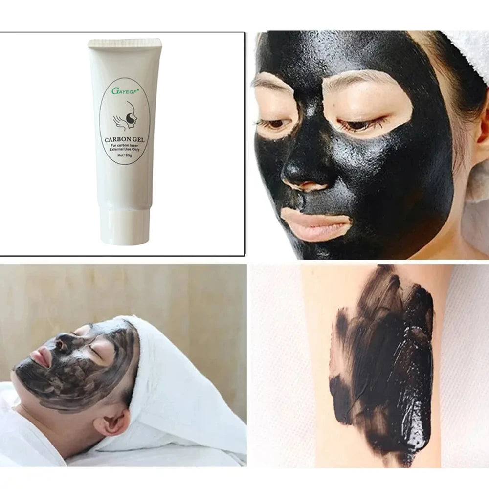 Carbon Black Gel Mask for ND:YAG Laser – Skin Peeling, Pore Minimizing & Whitening Carbon Cream (80ml)