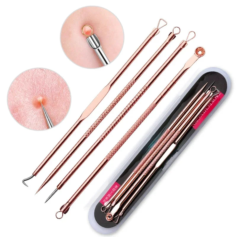 YJYIBEI Ultra-Fine Acne & Blackhead Extractor Set – 4-Piece Facial Pore Cleanser