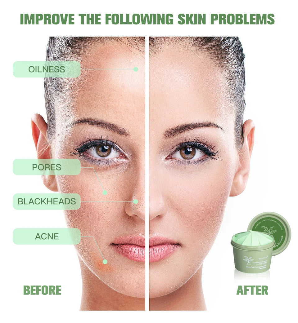 Green Tea Mud Clay Face Mask – Deep Pore Cleansing, Blackhead Removal & Oil Control Skin Treatment for All Skin Types (100g)