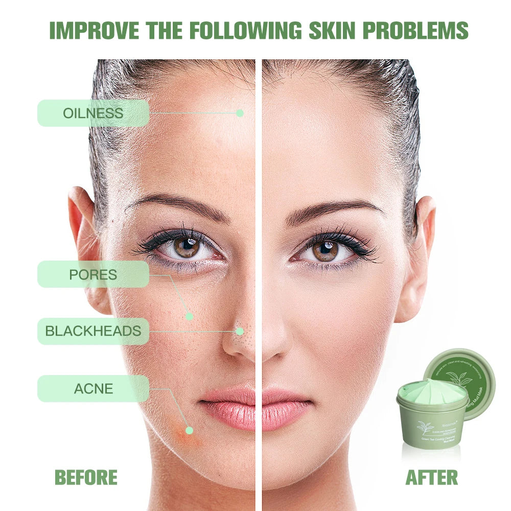 Green Tea Mud Clay Face Mask – Deep Pore Cleansing, Blackhead Removal & Oil Control Skin Treatment for All Skin Types (100g)