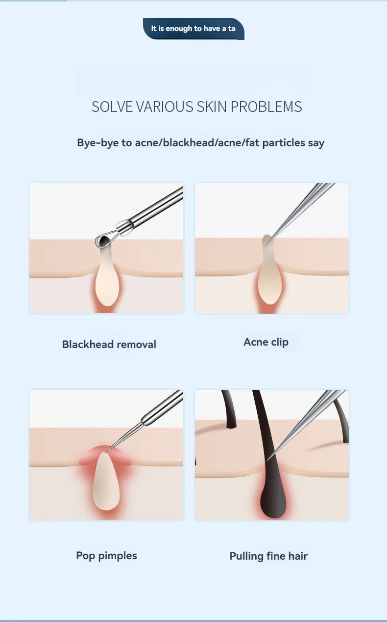 11-Piece Blackhead & Ingrown Hair Removal Tool Set – Acne Needles, Pore Cleaner & Tweezers Kit