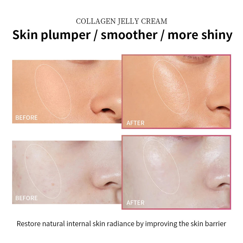 Collagen Niacinamide Hydrating Gel Cream 100ml