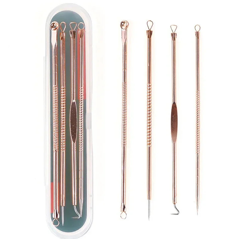 4-Piece Stainless Steel Acne & Blackhead Extractor Set – Pore Cleanser Kit