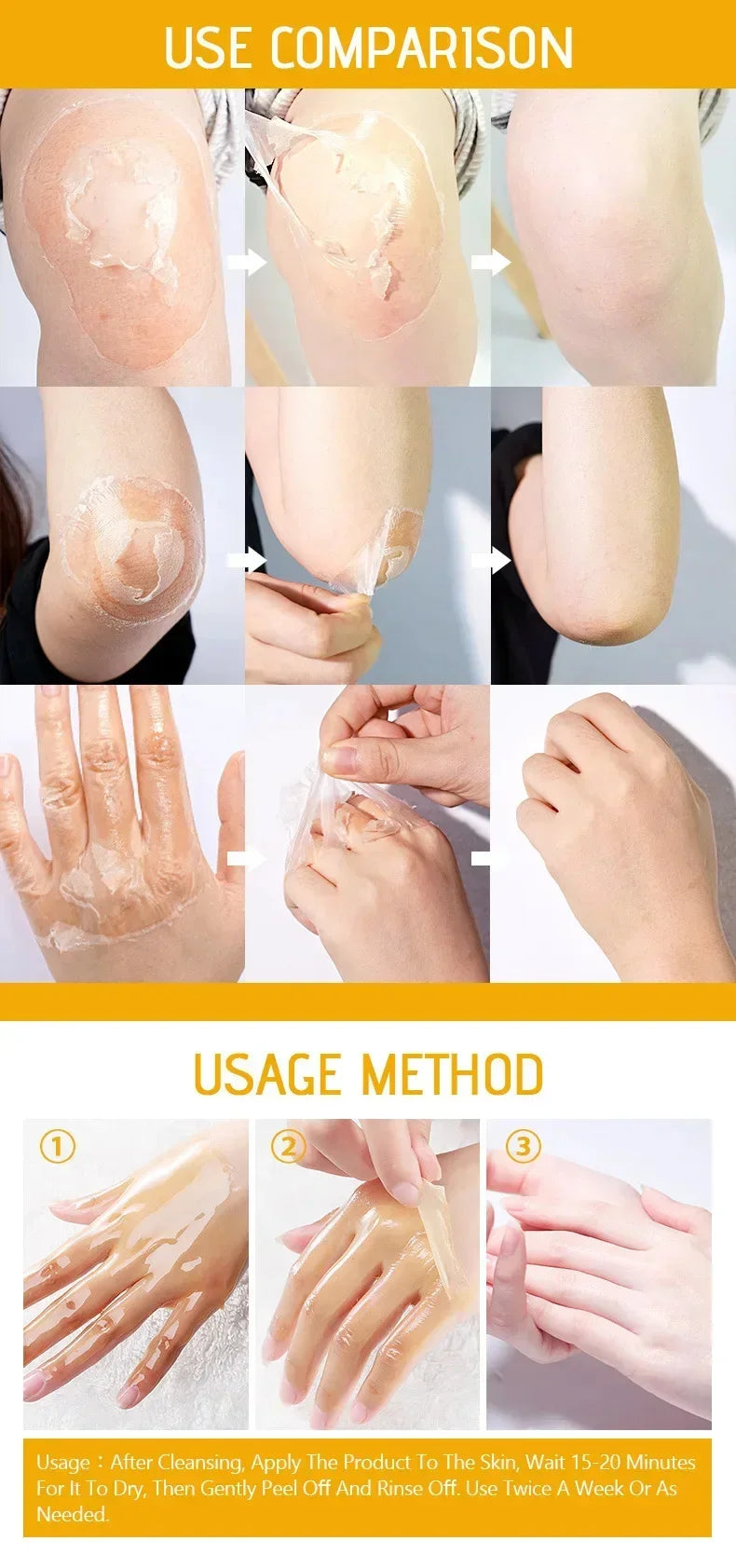 EELHOE Vitamin C & Hyaluronic Acid Body Peeling Lotion – Exfoliating & Brightening Skin Renewal Treatment (100ml)