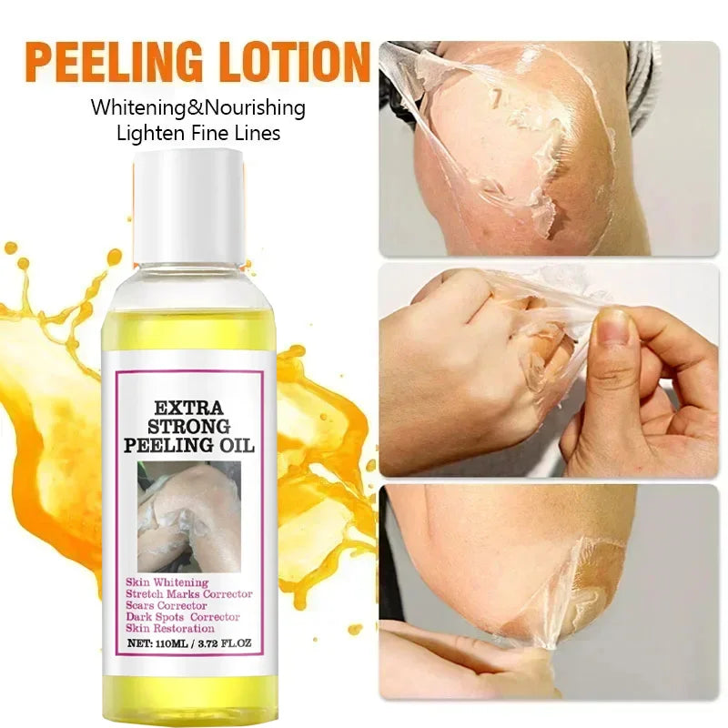 EELHOE Vitamin C & Hyaluronic Acid Body Peeling Lotion – Exfoliating & Brightening Skin Renewal Treatment (100ml)