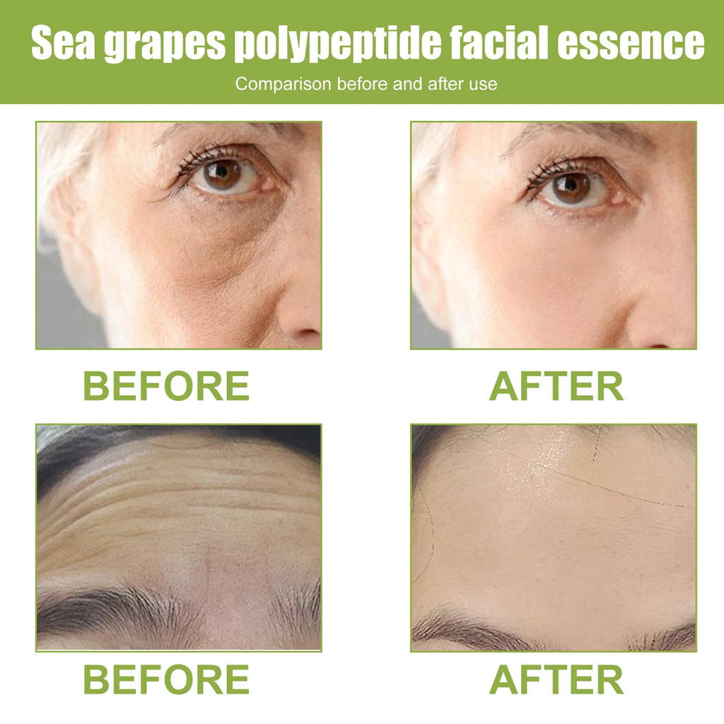 EELHOE Sea Grape Multi-Skin Anti-Wrinkle Essence Desalination Anti-aging Wrinkles Tightening Facial Skin