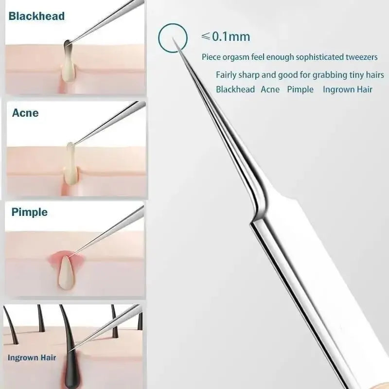11-Piece Blackhead & Ingrown Hair Removal Tool Set – Acne Needles, Pore Cleaner & Tweezers Kit