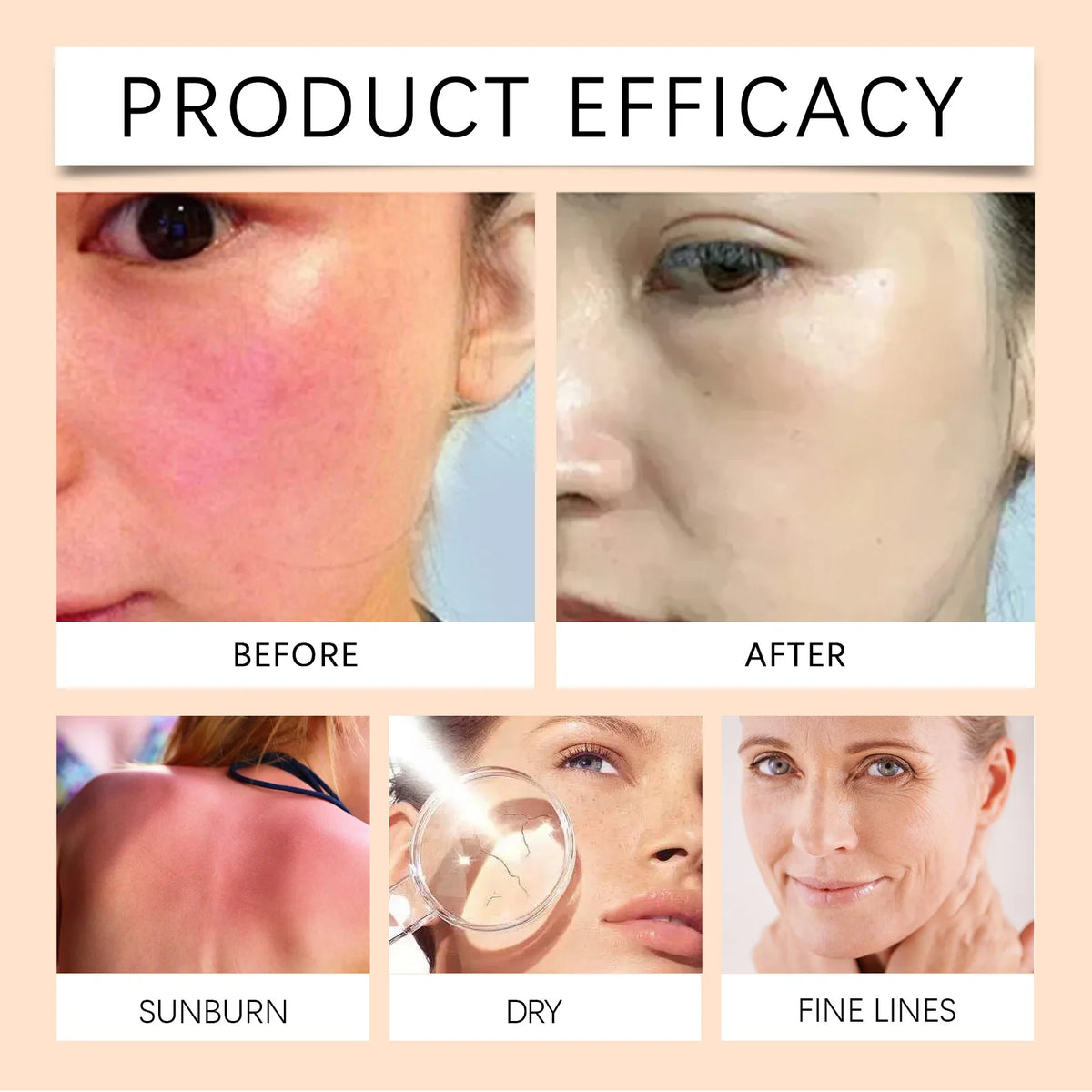 Eelhoe Vitamin E Sunscreen Spray 100ml – Long-Lasting UV Protection & Deep Moisturizing for Face
