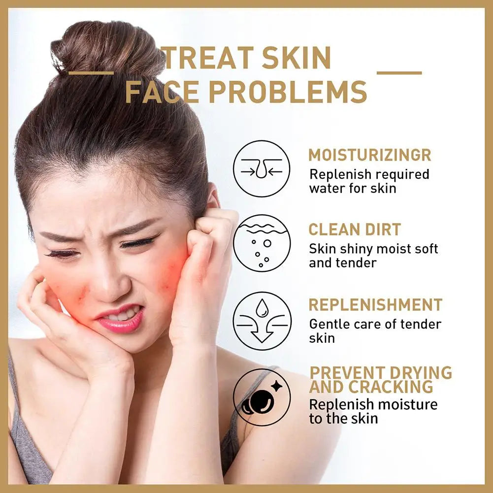 EELHOE Rice Face Toner – Hydrating & Barrier-Repair Skin Lotion for Softening, Firming & Moisturizing (150ml)