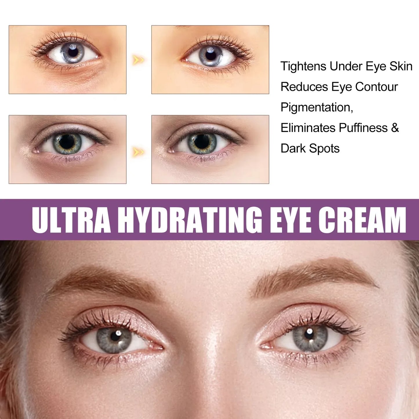 LAIKOU Retinol Eye Cream – Anti-Wrinkle, Dark Circle & Eye Bag Removal, 15g