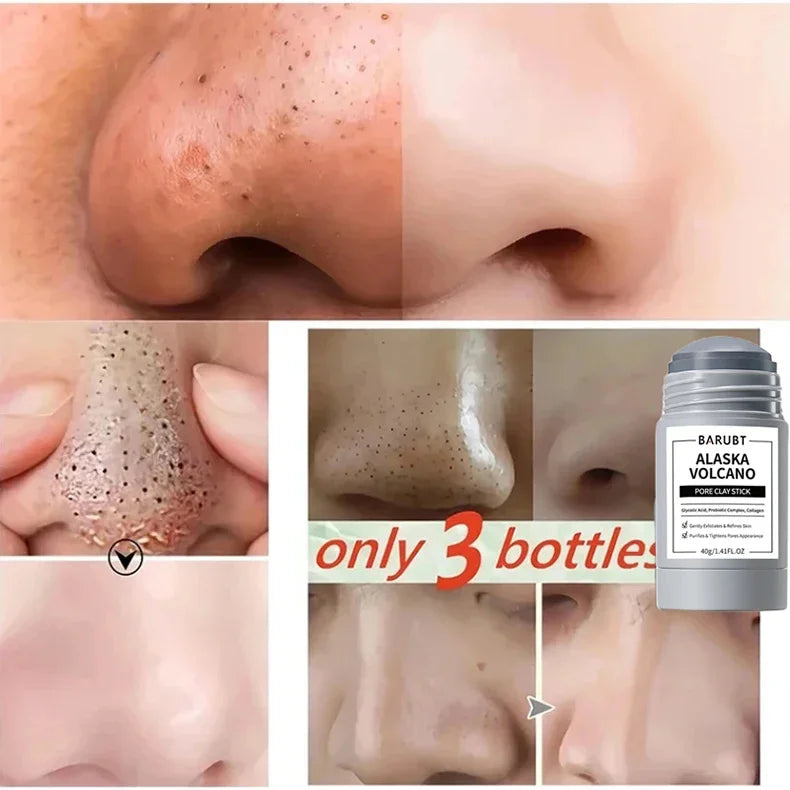 Jaysuing Cleansing Mask Stick – Mugwort, Alaska Volcano & More | Pore Minimizer & Acne Treatment 40g