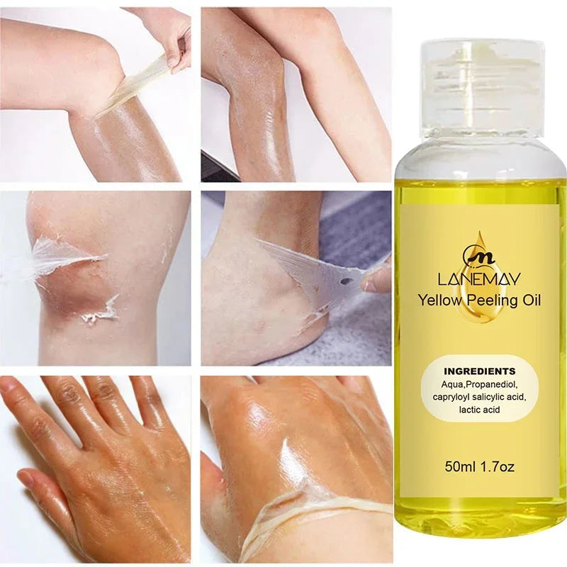 EELHOE Yellow Peeling Oil – Exfoliating Body Serum for Dark Spots, Knees, Elbows & Uneven Skin Tone (30ml / 50ml / 100ml)