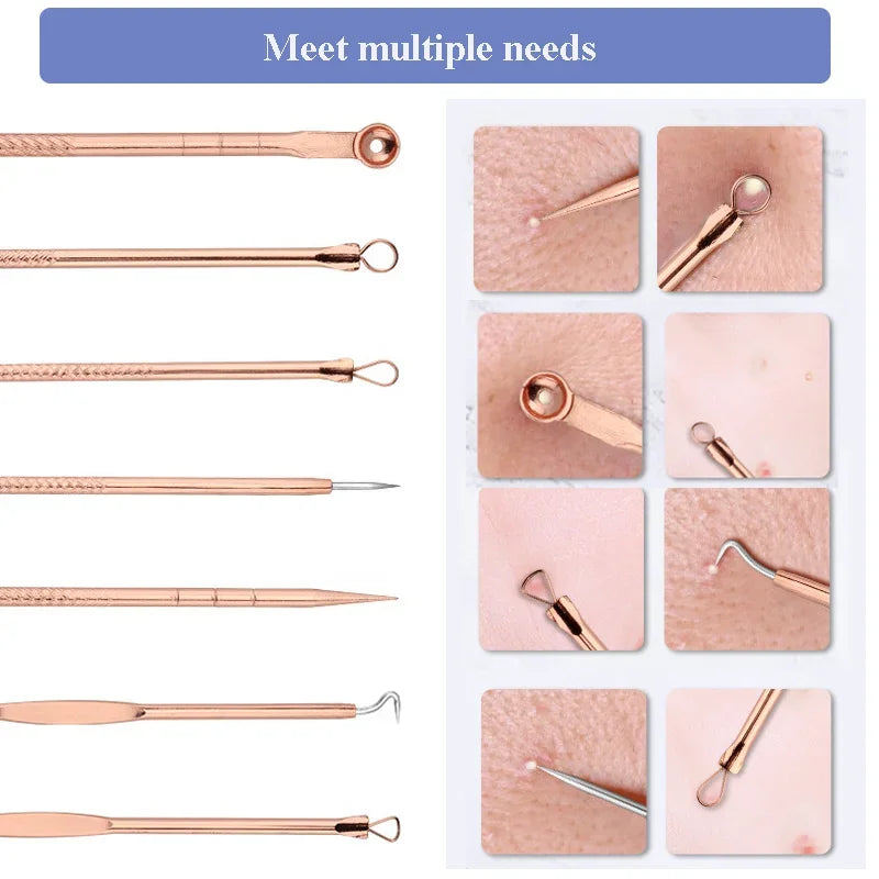 YJYIBEI Ultra-Fine Acne & Blackhead Extractor Set – 4-Piece Facial Pore Cleanser